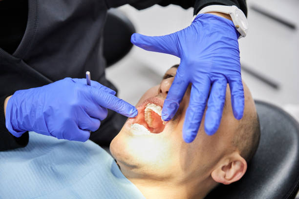 Best Broken or Cracked Tooth Emergency Dentist in Beaumont, TX