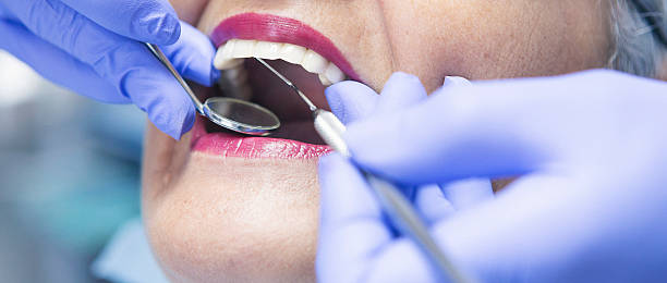 Best Emergency Dentist for Knocked-Out Tooth in Beaumont, TX